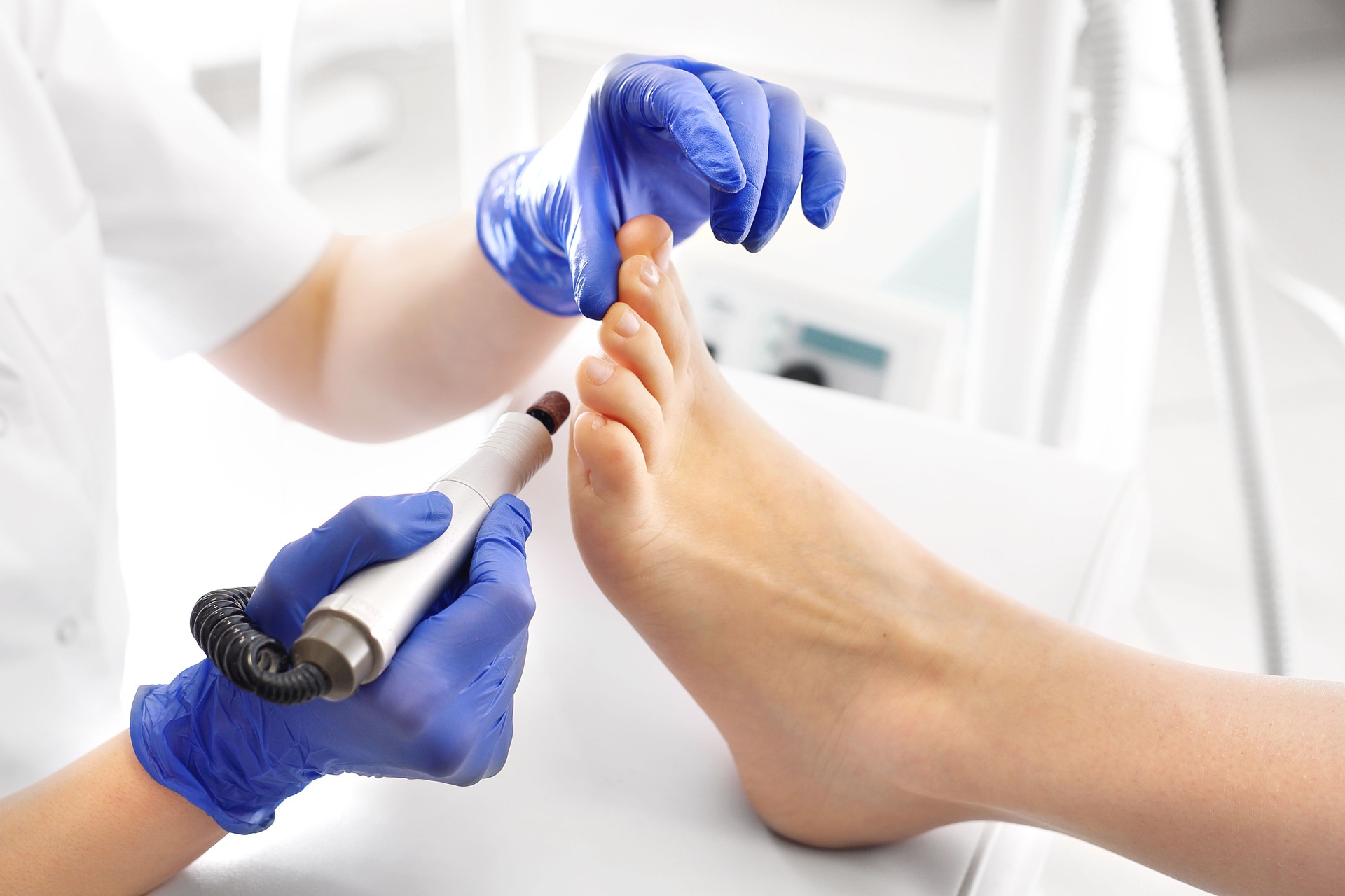 Pedicura médica. Podologist se convierte pies con una fresadora.
